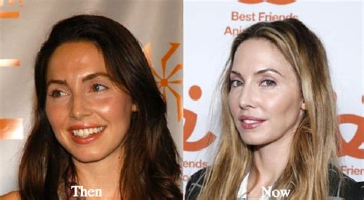 Whitney Cummings Nose Job Plastic Surgery Before and After